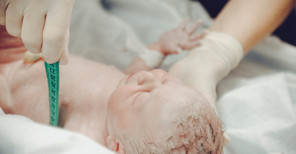 découvrez tout ce que vous devez savoir sur les hernies ombilicales : causes, symptômes, options de traitement et conseils préventifs pour protéger votre santé. informez-vous sur cette condition fréquente et les meilleures approches pour y faire face.